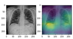 COVID-DenseNet: A Deep Learning Architecture to Detect COVID-19 from Chest Radiology Images